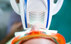 zoom whitening